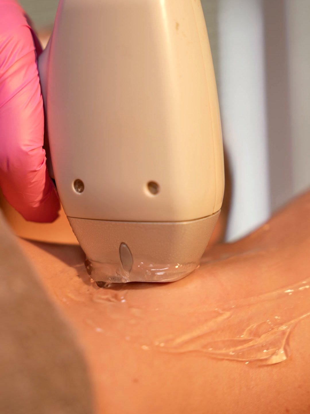 Soprano lazer epilasyon — SİS Nails Studio Üsküdar